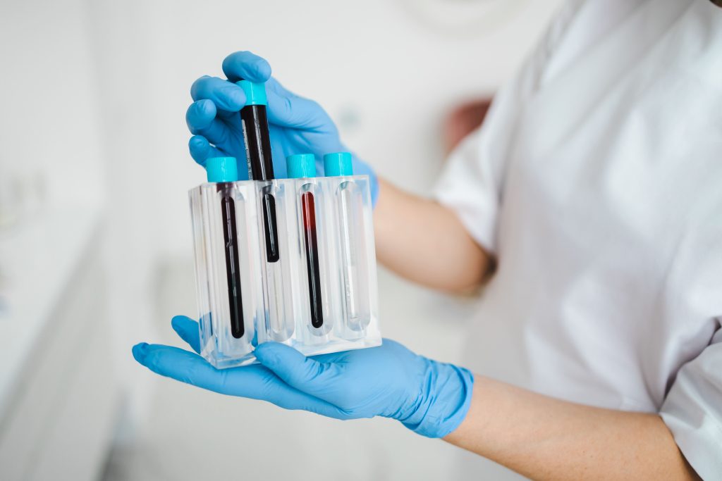 analisis hormonal pruebas fertilidad femenina fsh amh estradiol